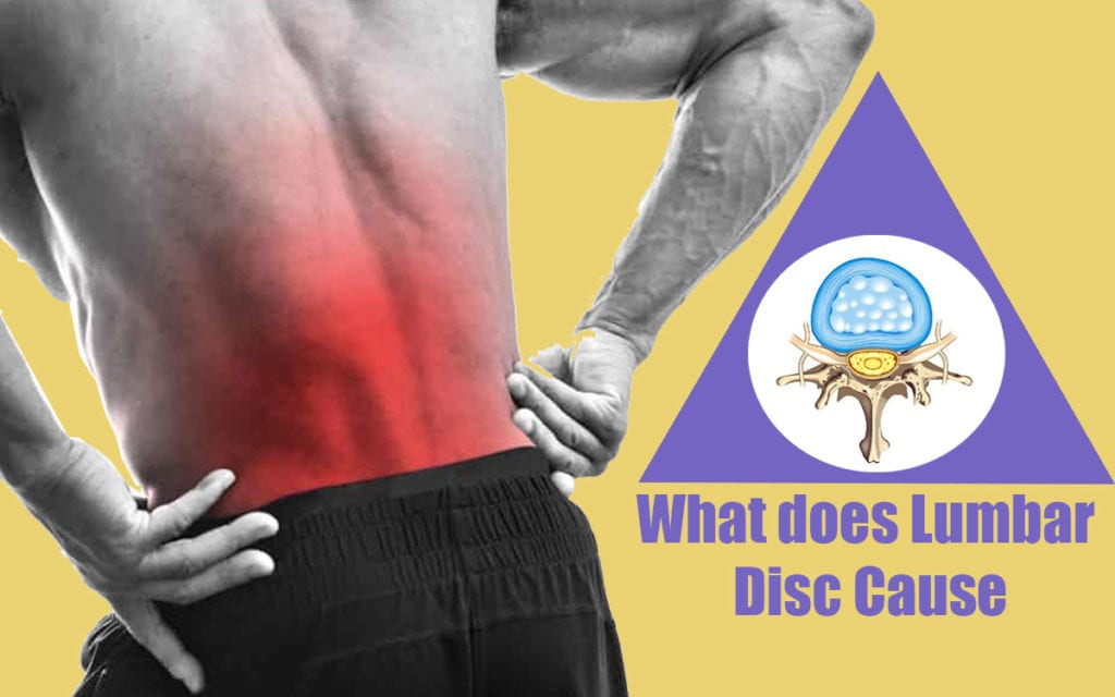 Suffering with Lumbar Disc problem Know all about Lumbar discs here
